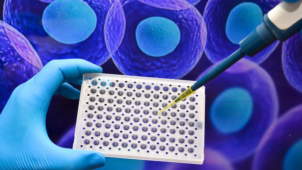 Silence Therapeutics issues intellectual property claim in the UK which ...