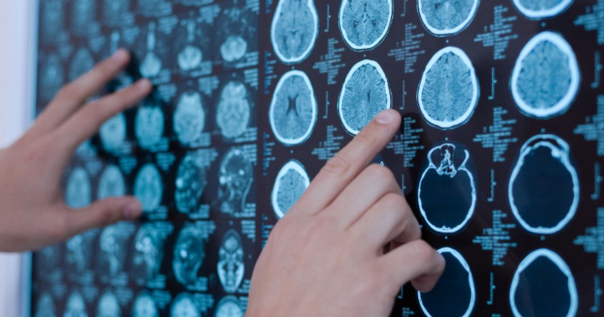 IQ-AI subsidiary receives US access programme approval for brain cancer treatment