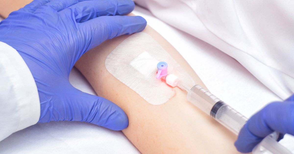 Intravenous injection. Intravenous injection
