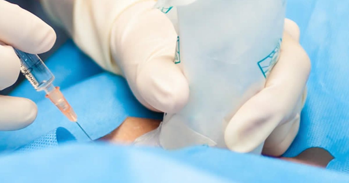 Intensity Therapeutics Doses First U.S. Patient in Phase 3 Study for Metastatic Sarcoma Treatment