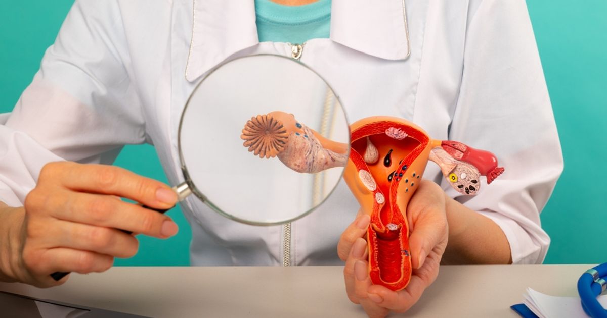 OS Therapies reports positive preclinical data for ovarian cancer ...
