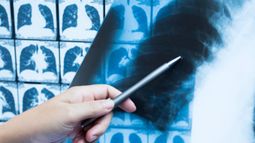 Polarean Imaging PLC - Polarean Imaging receives "clear indication of belief in the company" from major shareholder