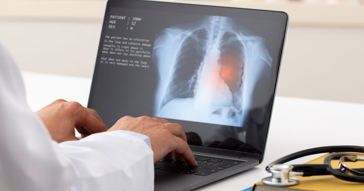 LungLife AI announces success in Validation of LungLB in multisite