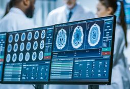 IQ-AI advances glioblastoma clinical trial, eyes phase two in 2025