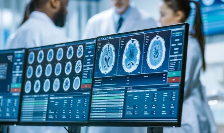 IQ-AI advances glioblastoma clinical trial, eyes phase two in 2025
