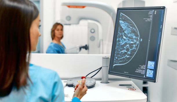 Atossa Therapeutics doses first patient with (Z)-endoxifen in Phase 2 ...