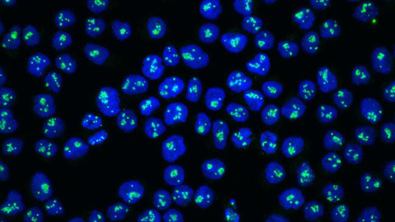 Researchers identify new pathway for acute lymphoblastic leukaemia ...