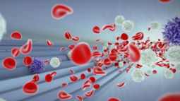 ANGLE PLC - ANGLE PLC&rsquo;s new approach to Cancer diagnostics with Parsortix - One2One Investor Forum