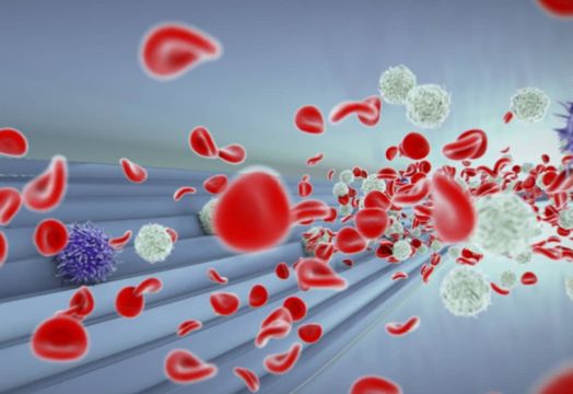 ANGLE PLC - ANGLE PLC&rsquo;s new approach to Cancer diagnostics with Parsortix - One2One Investor Forum