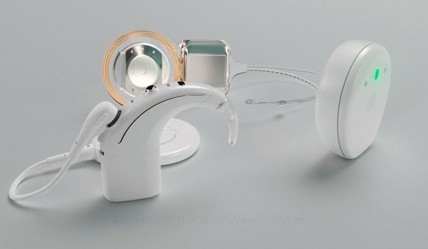 Cochlear downgrades FY25 earnings guidance, unveils smart cochlear ...