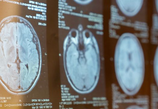 Immunic Inc - 