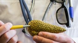 Inside Biotech: OncoSil&rsquo;s TGA breakthrough puts focus back on pancreatic cancer challenge