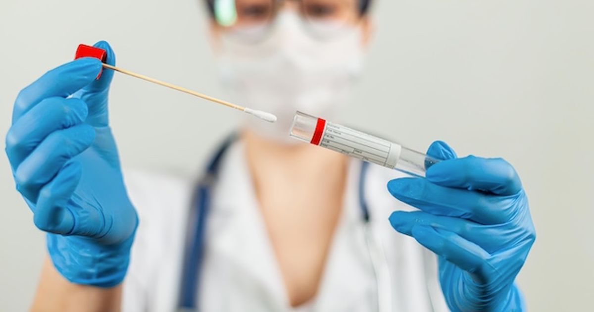 BioVie: Long COVID trial fully enrolled – ICYMI