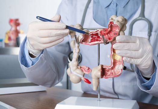Agenus Inc - Agenus shares surge as company secures up to $340M to advance colon cancer trial