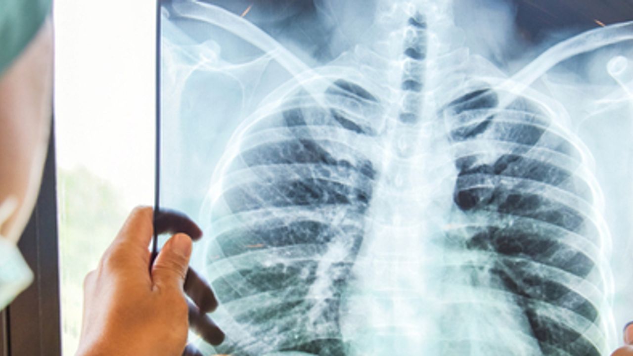 4DMedical Ltd - 