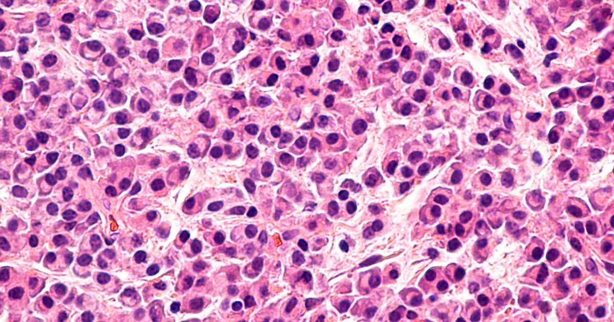 Tech Bytes: FDA update reshapes the multiple myeloma development playbook