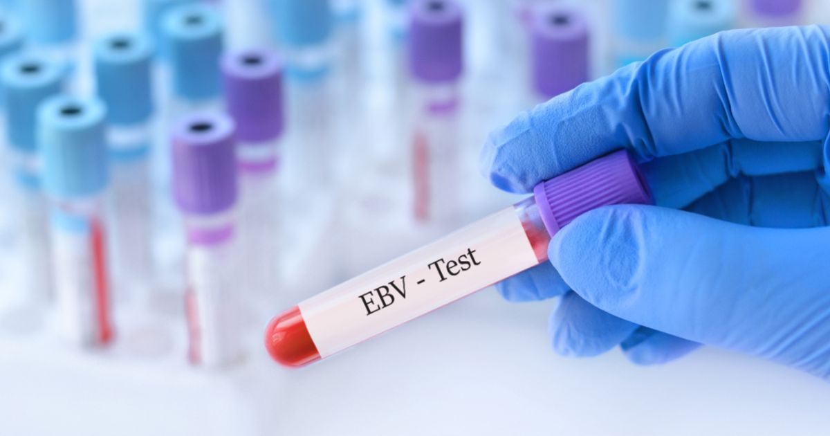 Inside Biotech: A long-standing MS mystery comes into focus