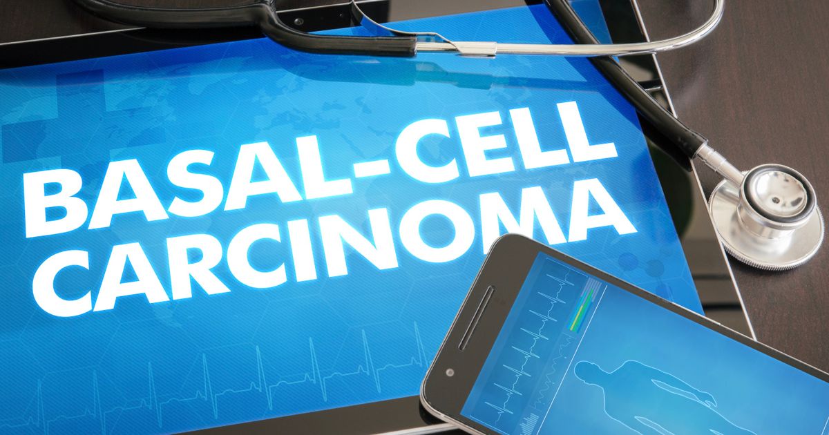 Medicus says Phase 2 data supports further development of SkinJect therapy for skin cancer