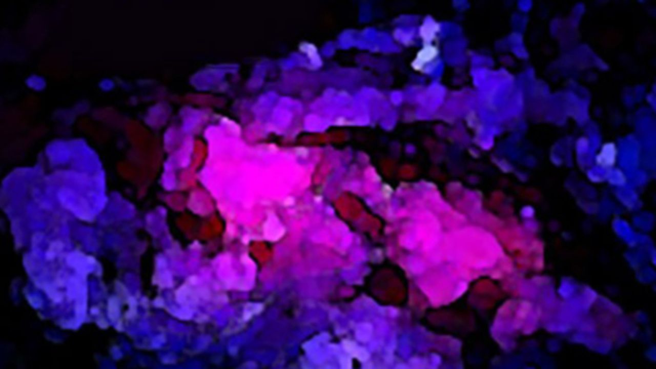 Medexus gets Health Canada nod to market tumor imaging material Gleolan ...