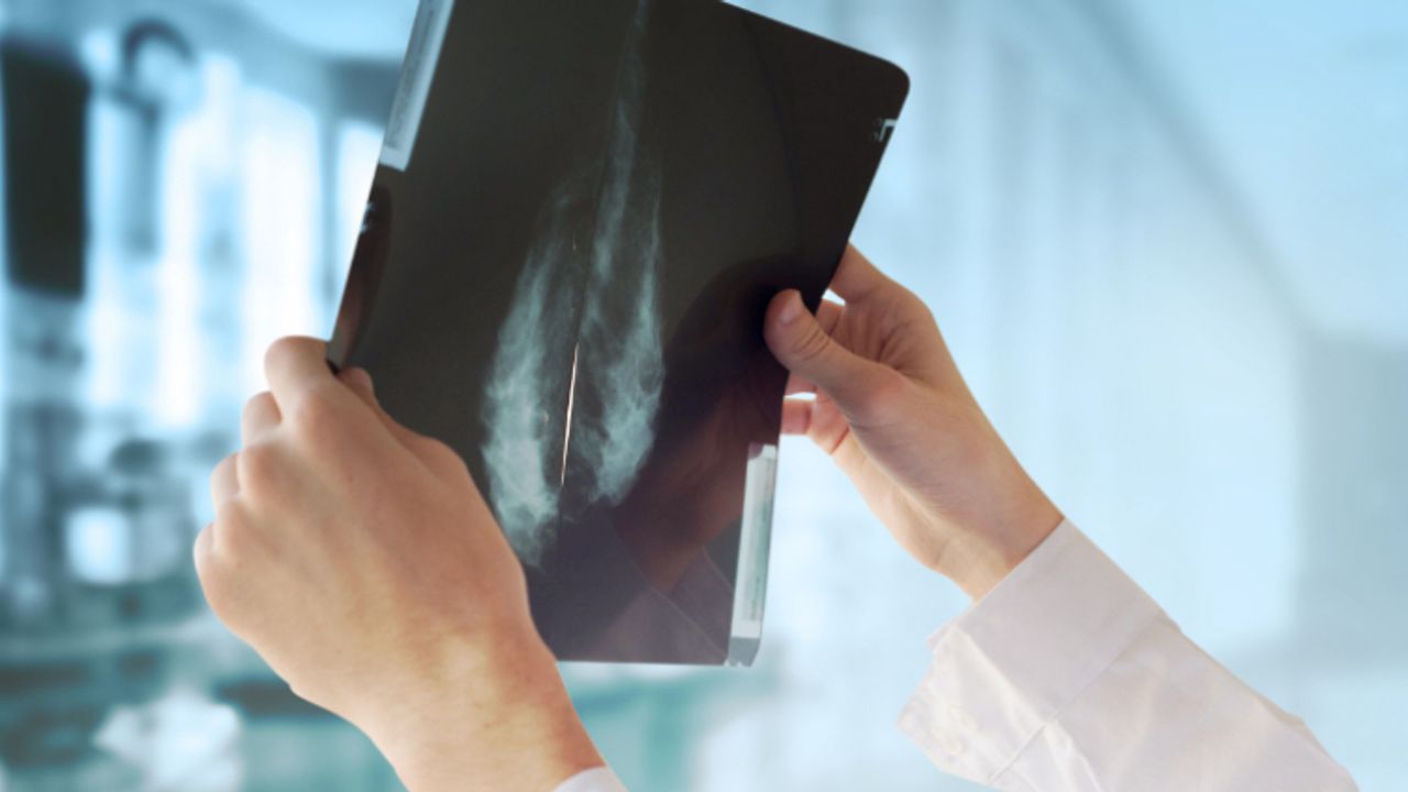 CytoDyn’s impressive run continues for leronlimab in metastatic triple ...