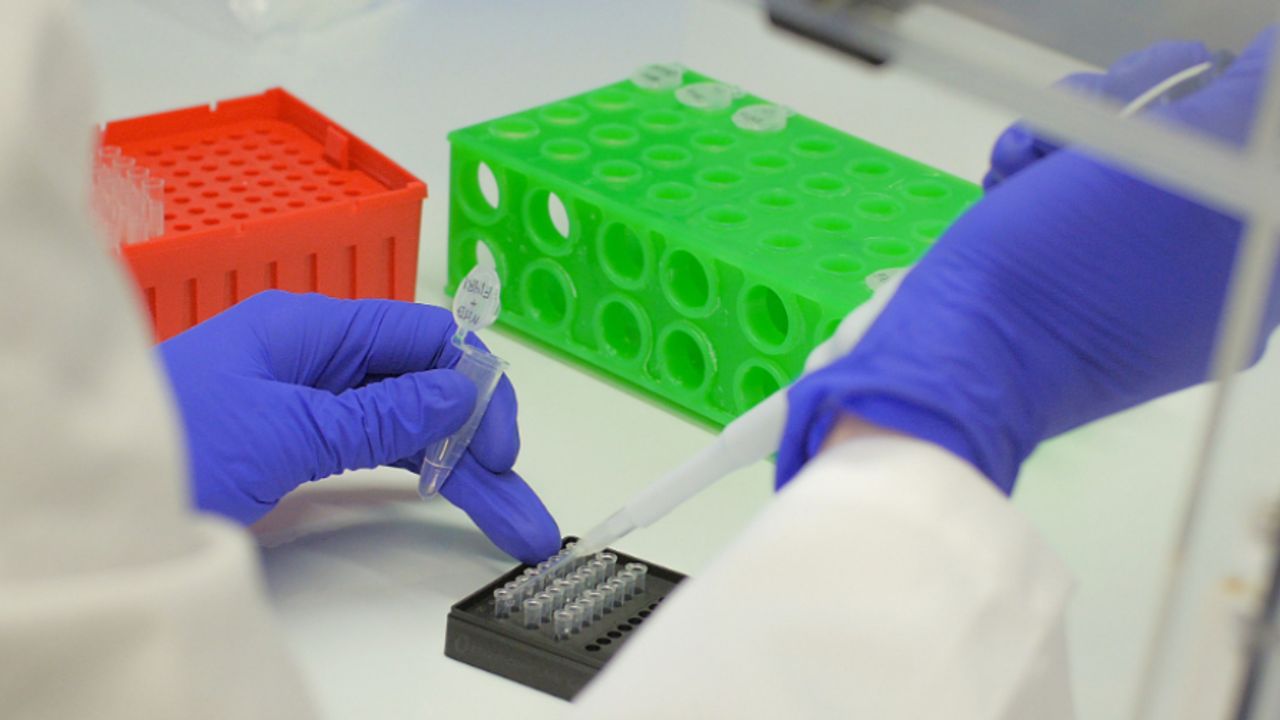 Co-Diagnostics says its Logix Smart kit to be used with saline oral ...