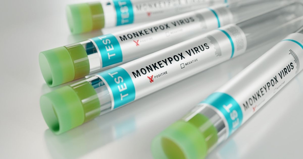 Co-Diagnostics Inc ships monkeypox virus tests to international distributor to fight multi-country outbreak - Vimarsana News