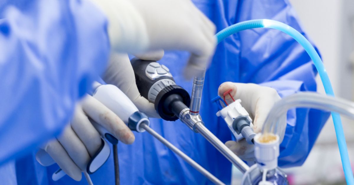 Creo Medical Group PLC revenues set to exceed expectations as its strategy continues to deliver - Vimarsana News