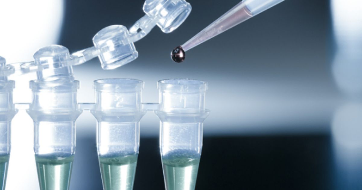 Amplia Therapeutics Ltd's latest results suggest candidate improves survival in human pancreatic cancer model - Vimarsana News