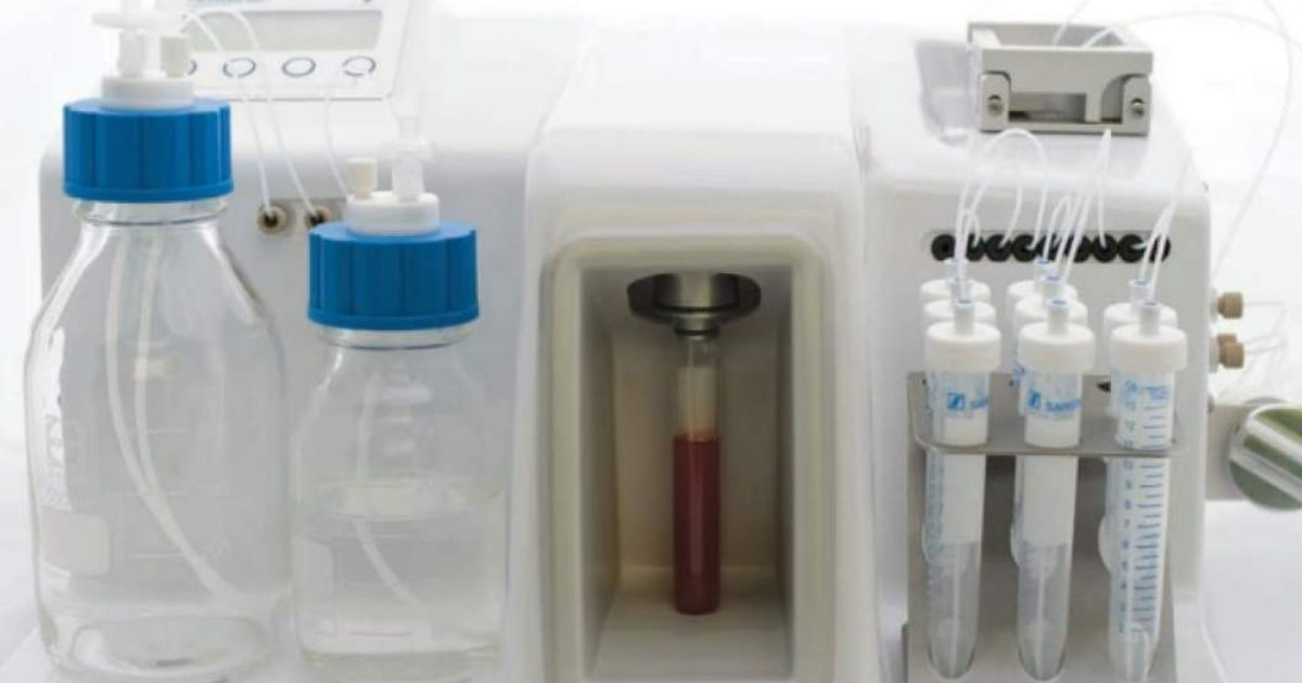 ANGLE's Parsortix used to analyse and inform treatment for aggressive form of breast cancer