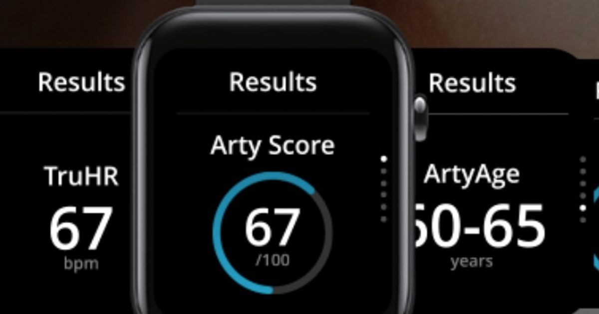 CardieX and Mobvoi launch heart health monitoring smartwatch TicWatch ...