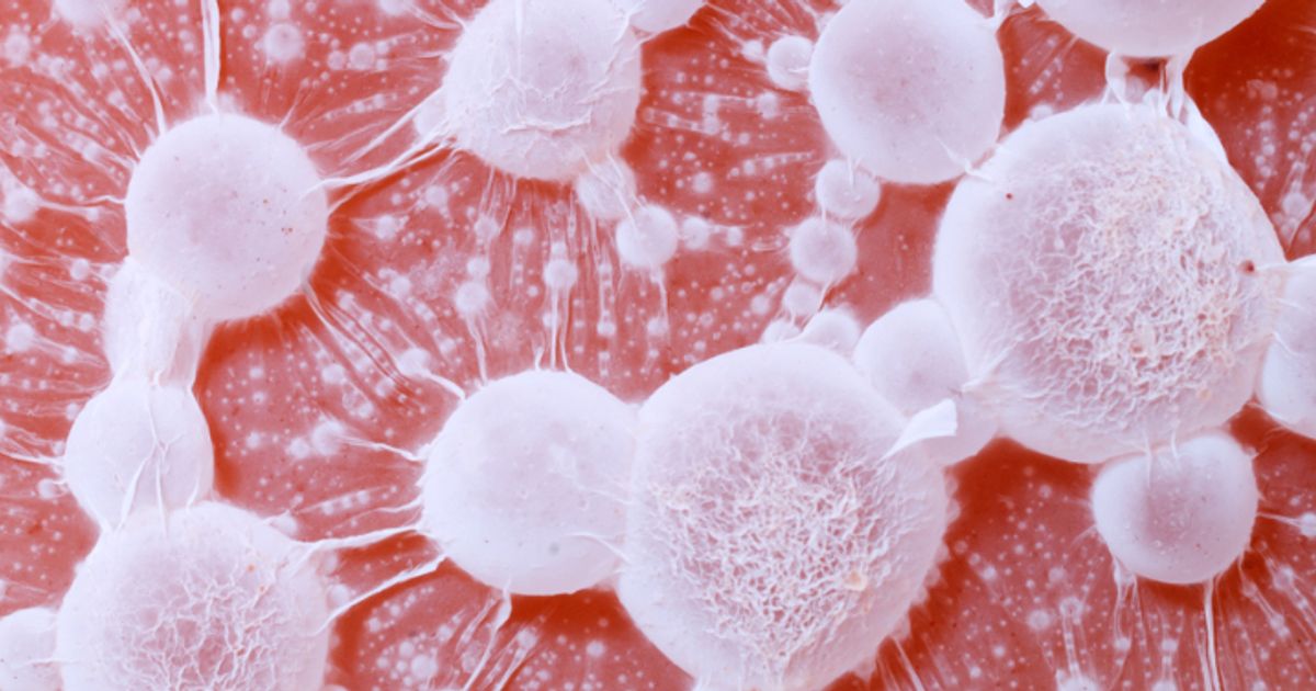 Radiopharm Theranostics Ltd welcomes positive Phase 2 data for F-18 Pivalate in brain metastases trial - Vimarsana News