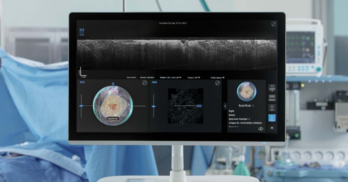 Breast Surgical Oncologist discusses game-changing technology in Perimeter S-Series OCT system - Vimarsana News