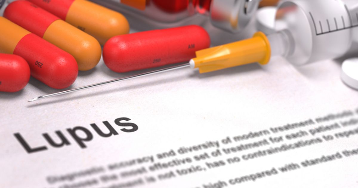 ImmuPharma edges closer to major breakthrough for lupus drug - Vimarsana News