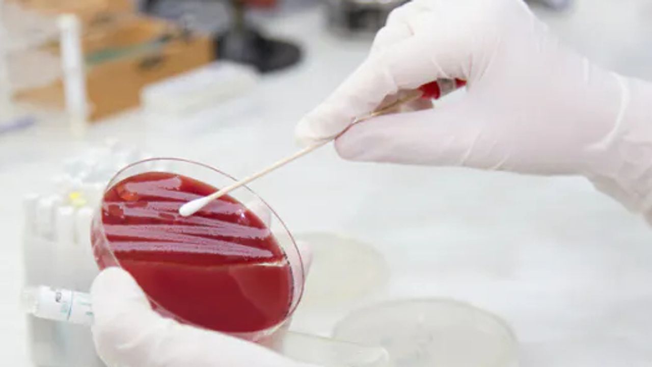 Recce Pharmaceuticals makes strides with R327G drug in multiple ...