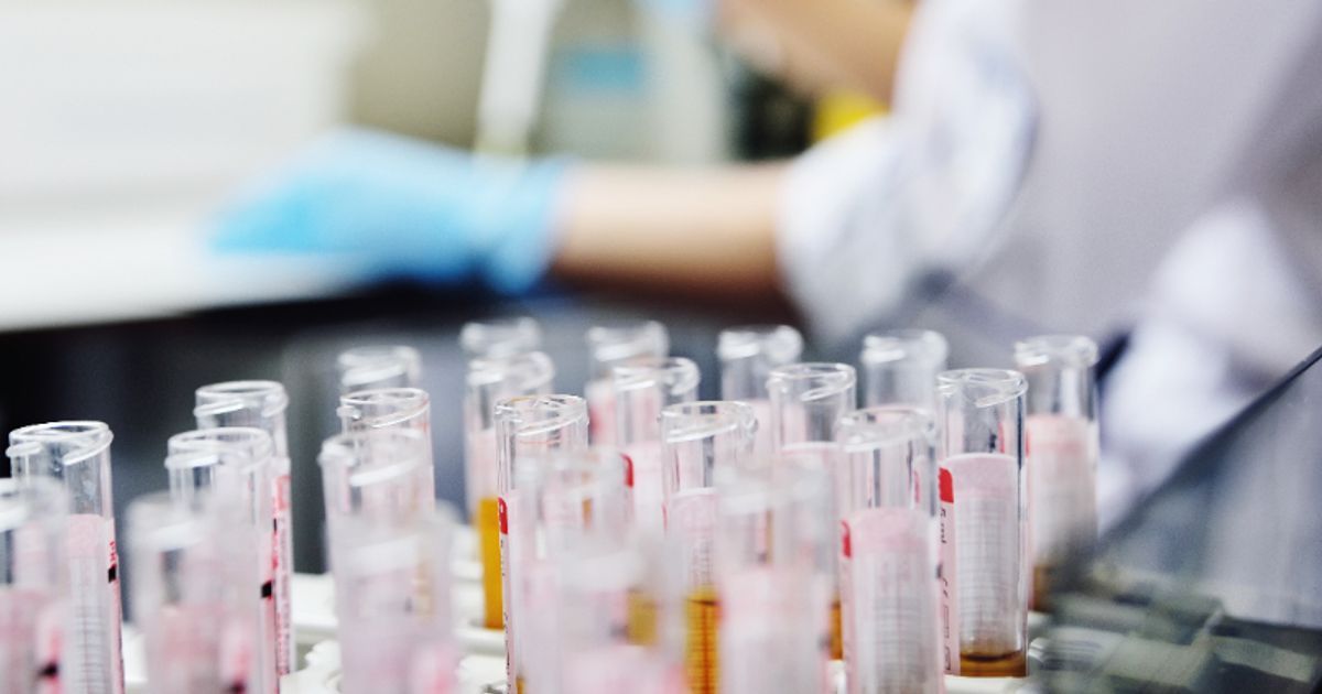 Genetic Technologies granted approval for pancreatic cancer, melanoma and atrial fibrillation testing - Vimarsana News