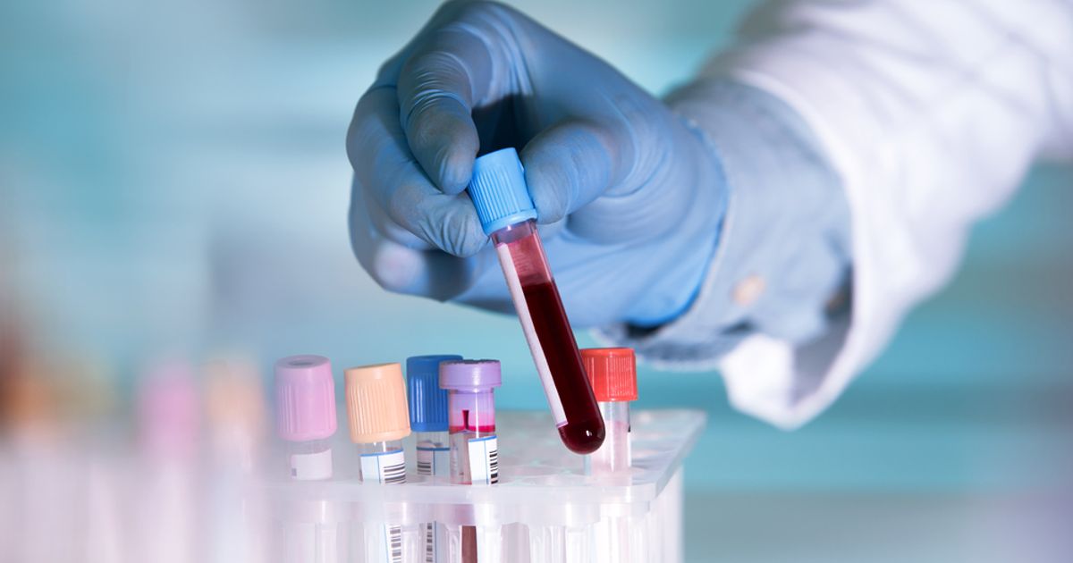 C4X Discovery Holdings PLC flags early potential of new blood-borne cancer drug candidate - Vimarsana News