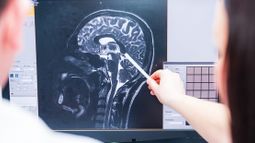 Eli Lilly and Co - brain, Alzheimer's, dementia, pharma, biotech, research