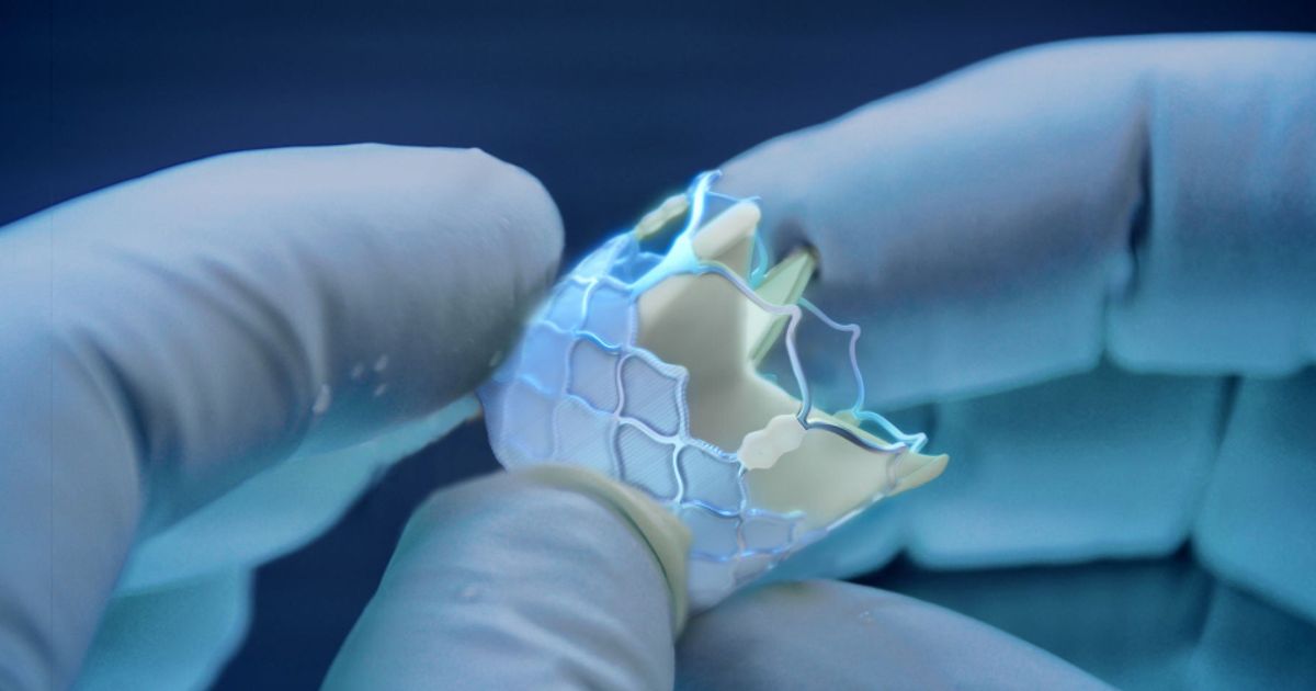 Anteris talks market superiority of its biomimetic TAVR valve - Vimarsana News