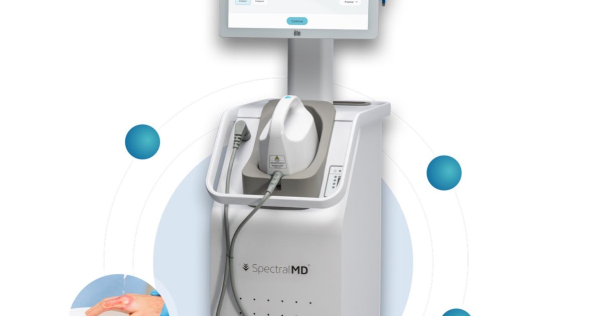 Spectral AI surges as wound imaging device gets approval in US and UK - Vimarsana News