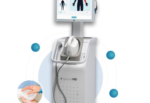 Spectral AI Inc - Spectral AI shares surge as wound imaging device wins regulatory approvals in US and UK - Spectral MD Holdings (Wound Imaging Machine