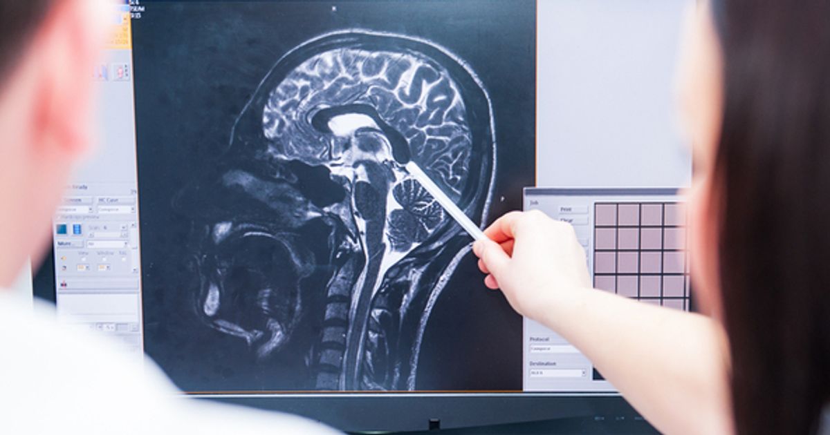 IQ-AI higlights use of subsidiary's software in brain cancer study - Vimarsana News