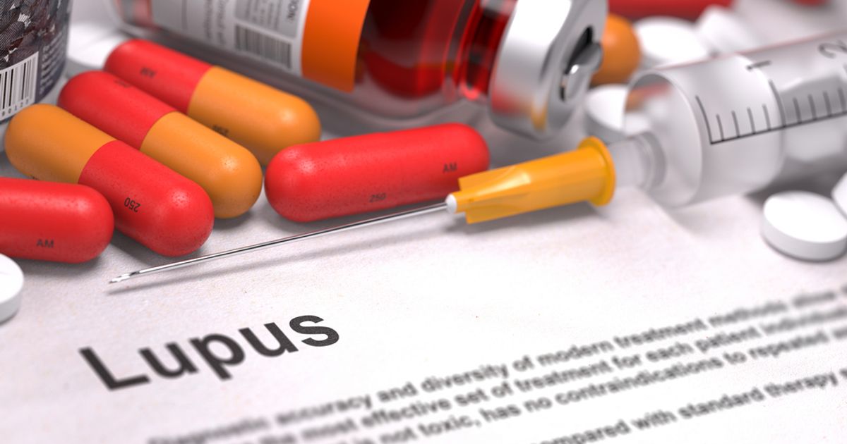 Roivant Sciences gets disappointing lupus drug results in Phase 2 study - Vimarsana News