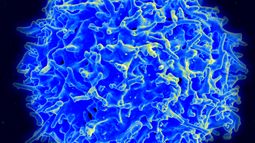 cancer-cells