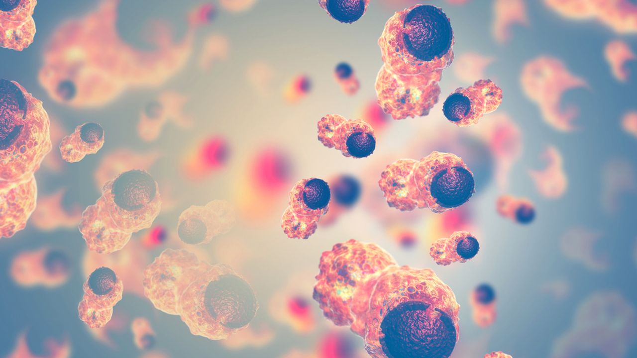 AVEO Pharmaceuticals’ Phase 3 trial of tivozanib in renal cell ...